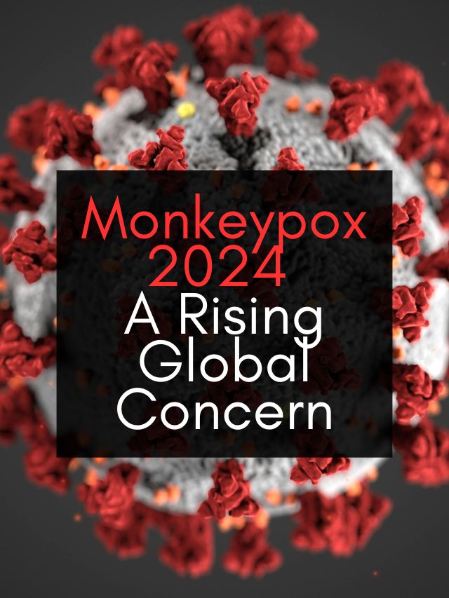 Monkeypox 2024: A Rising Global Concern